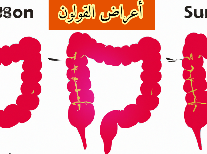 أعراض القولون